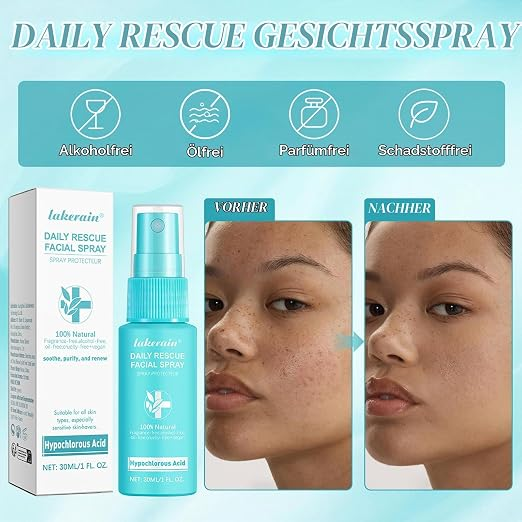 Ekukeon Hypochlorous Acid Hypochlorous Acid Scalp  Spray 30 ml