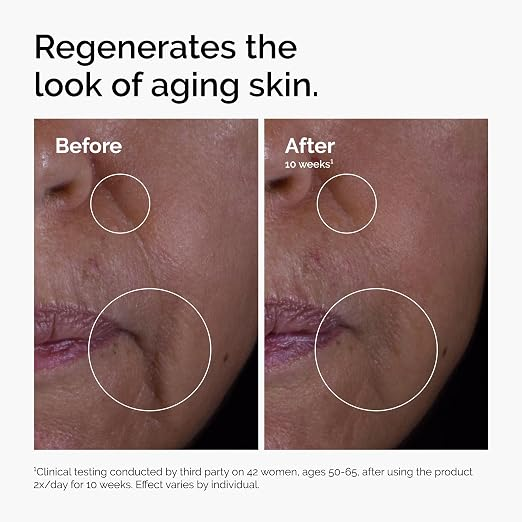 The Ordinary GF 15% Solution, Anti-Aging Formula for Visible Skin & Wrinkle Repair, 1 Fl Oz