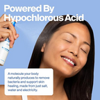 Magic Molecule Skin Spray Hypochlorous Acid Solution 8oz