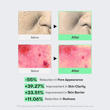 VT COSMETICS CICA Reedle Shot 100 Microneedling Serum 50ml