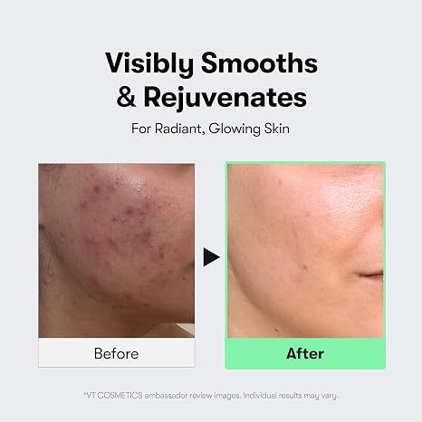 VT COSMETICS CICA Reedle Shot 100 Microneedling Serum 50ml