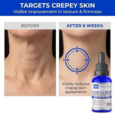 Skin Perfection 1% GHK-Cu Copper Peptides Serum for Face, Hair & Scalp .5oz