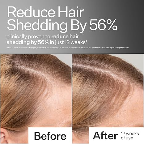 Act+ Acre, Stem Cell Scalp Serum, Reduces Shedding 65ml