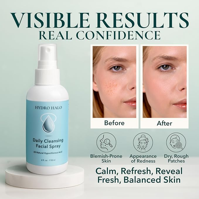 Hydro Halo 0.02% Hypochlorous Acid Spray for Face & Skin – Hydrating Facial Mist 118ml