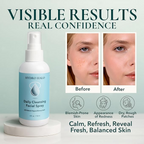 Hydro Halo 0.02% Hypochlorous Acid Spray for Face & Skin – Hydrating Facial Mist 118ml