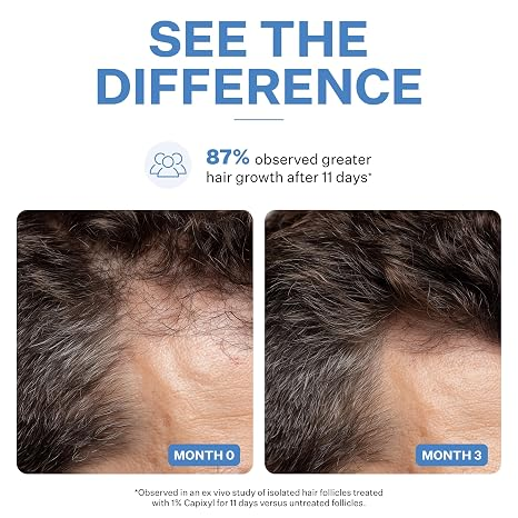 Capixyl Hair Growth Serum 5% For Density Peptide Scalp Treatment 30ml